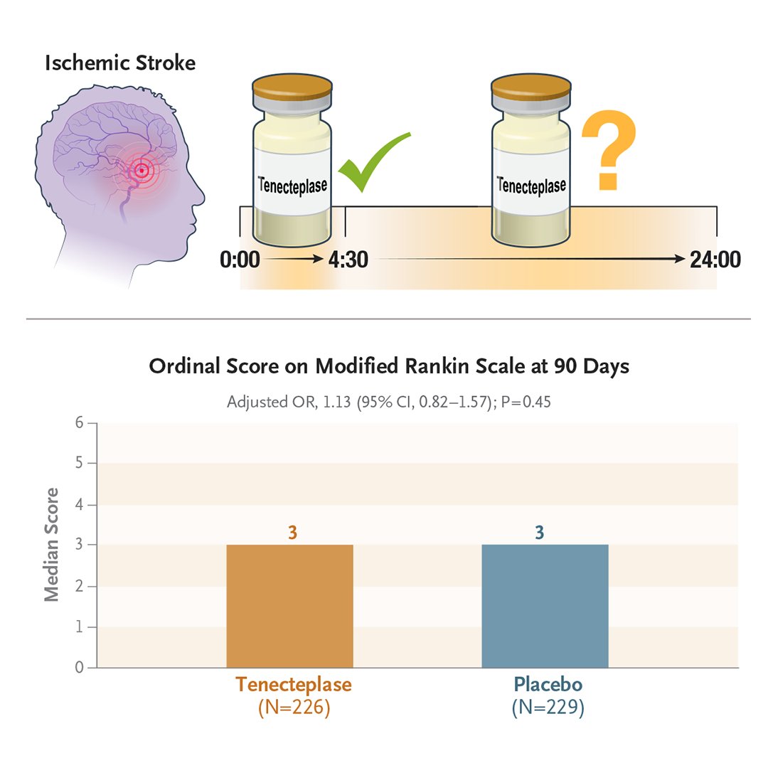 Tenecteplase for thrombolysis in a 4.5-to-24-hour window did not improve disability outcomes at 90 days in patients with ischemic stroke who had been chosen on the basis of imaging. Most patients had endovascular thrombectomy. Full TIMELESS trial results: nej.md/3wa2tAR