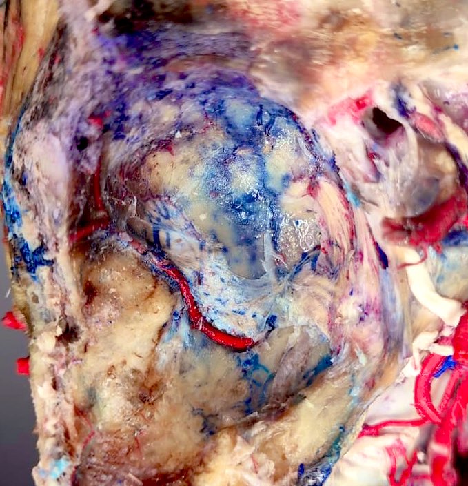 RAlmufarriji's tweet image. Middle fossa #labwork ©️