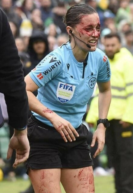 donTonio66's tweet photo. Spagna, la guardalinee Porras è una maschera di sangue dopo aver sbattuto contro una telecamera e sui social in tantissimi fanno commenti sessisti.
Mi rendo conto che definire deficienti gli autori dei commenti è troppo poco. https://t.co/uvlSSP5vLA