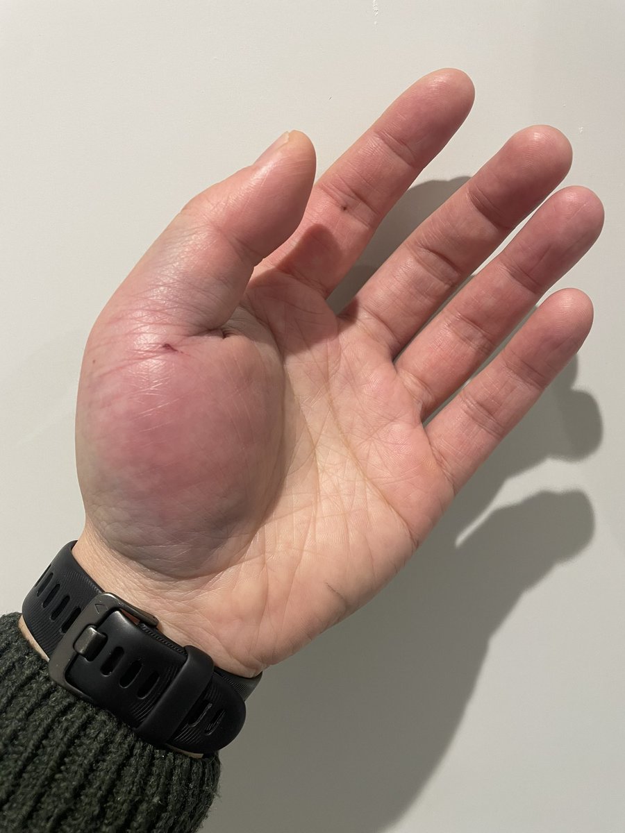 Pakchum Tse aka Patch tweet media