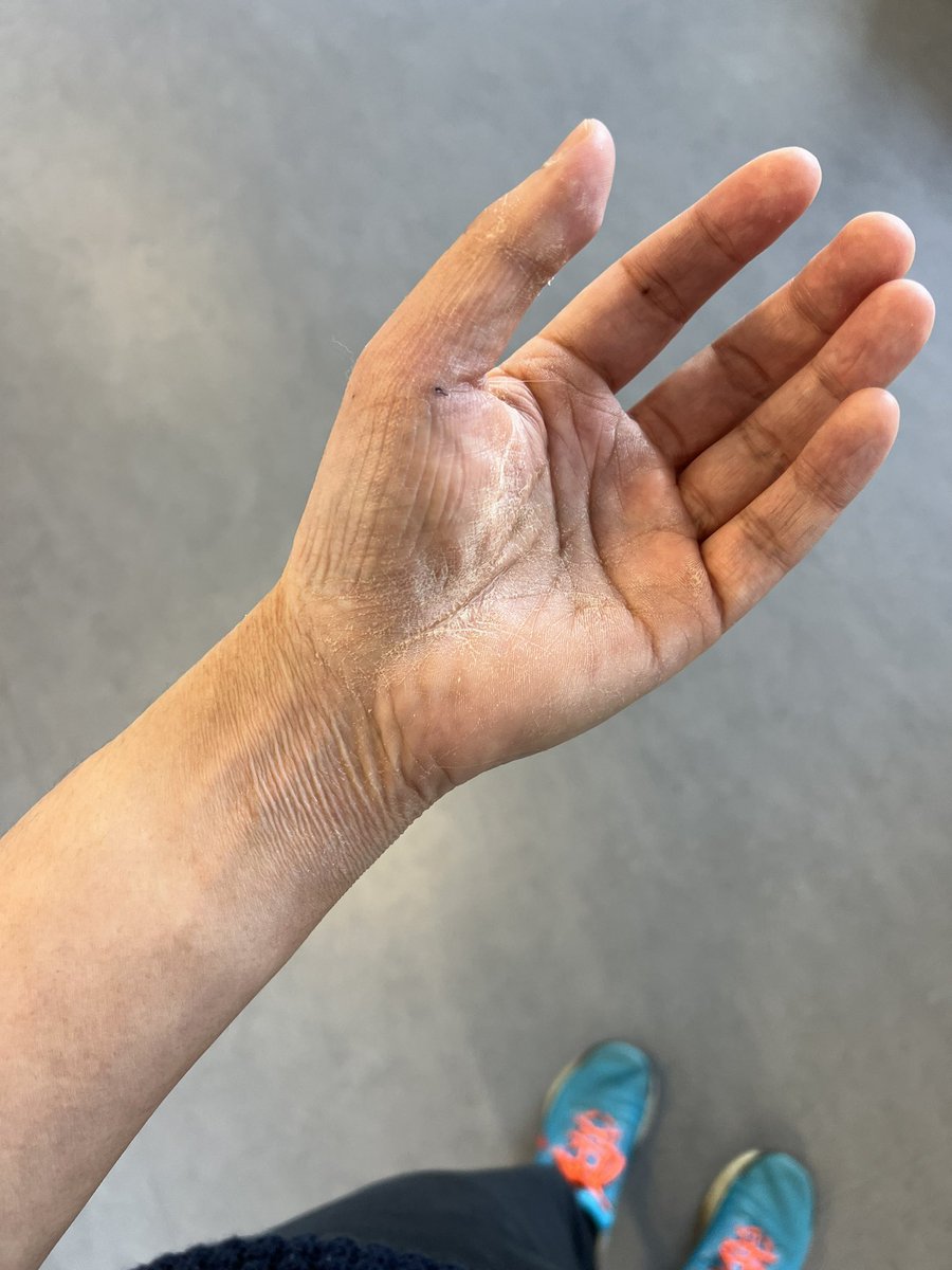 Pakchum Tse aka Patch tweet media