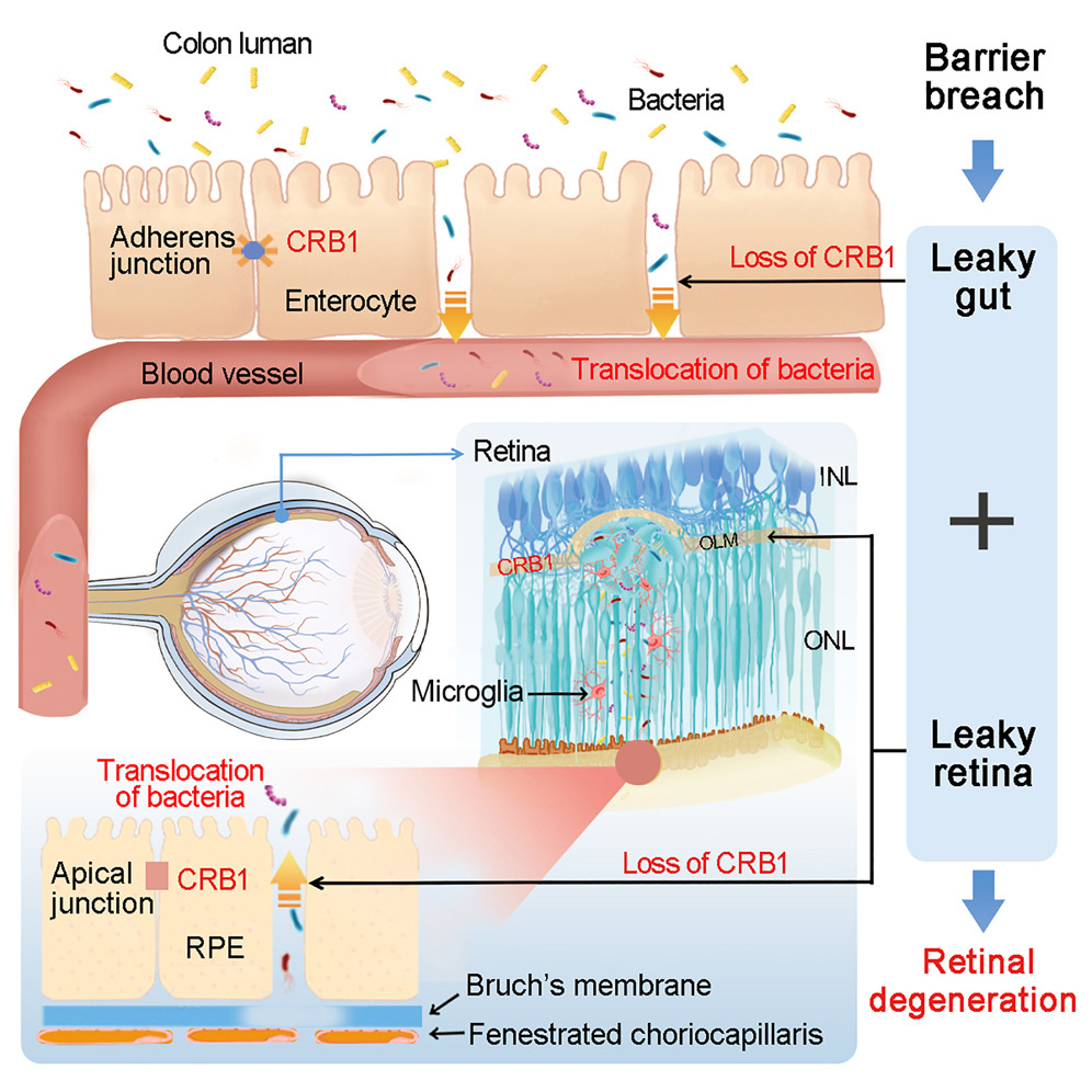 A new connection between the gut microbiome and the retina, raising the question as to whether antibiotics could help prevent blindness in some heritable conditions @justsaysinmice 
cell.com/cell/abstract/… <a href="/CellCellPress/">Cell</a> 
nature.com/articles/d4158… <a href="/Nature/">nature</a>
