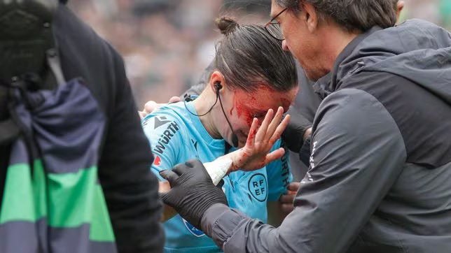 Cbet_latam's tweet image. Guadalupe Porras tuvo que ser retirada en camilla del partido entre Betis y Athletic tras un choque con una cámara de televisión.

#guadalupeporras #porras #wism #womeninfootball #womeninsports #incident #referee
