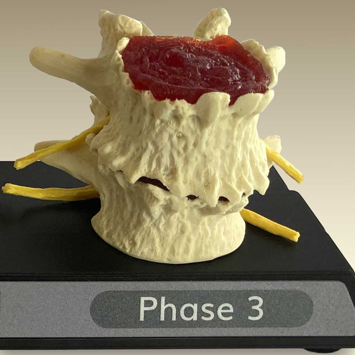 ChiroOutfitters's tweet image. Lumbar Spine Models Bring Your Report of Findings to Life. chiropracticoutfitters.com/Spine-Degenera… #spinemodel