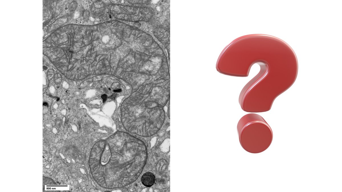 A megamitochondrion with a question #TEM #PathArt #Pathology #PediPath <a href="/UTSW_PediPath/">Pediatric Pathology at UT Southwestern</a> <a href="/UTSW_Pathology/">UTSW Department of Pathology</a>
