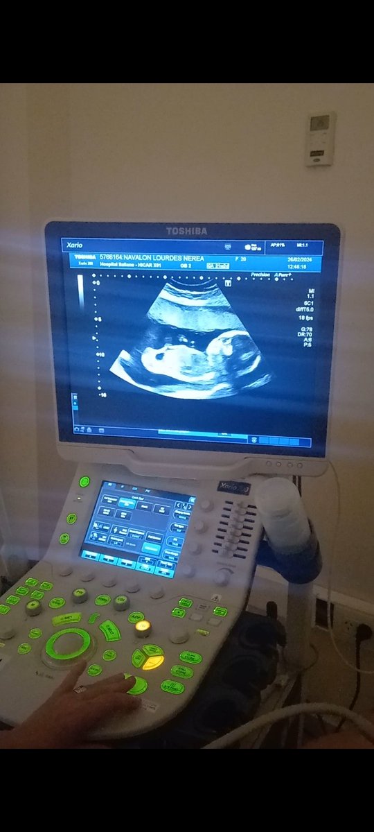 Hola madrina, hoy escuche tu corazóncito..🥺❤‍🩹💙
