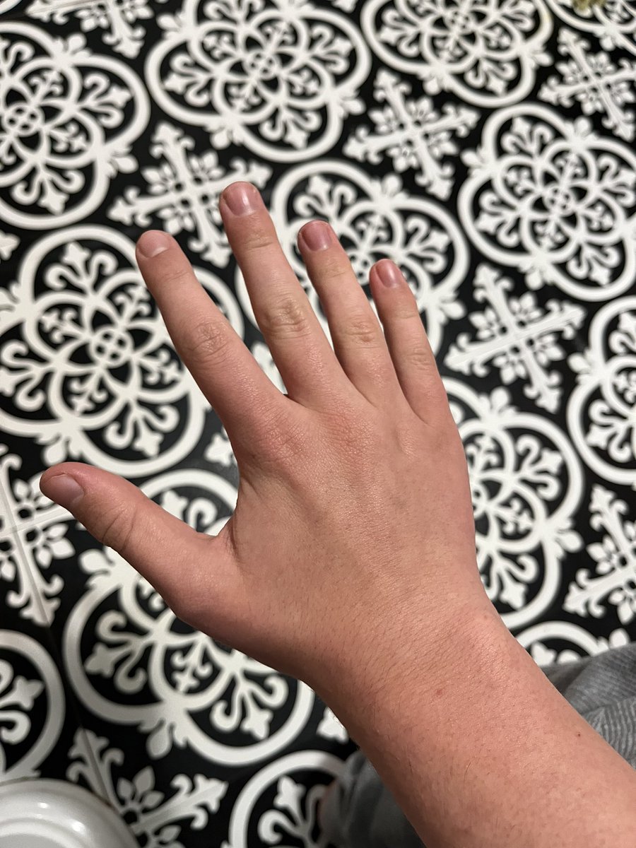 theKrabs_11's tweet photo. Krabs hand reveal I guess 🗿 https://t.co/dDUu3xrw27