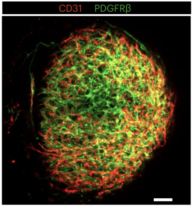 The team of Christoph Klein @LMU_Muenchen report a complex bone marrow organoid system developed from human induced pluripotent stem cells to model the human bone marrow niche. nature.com/articles/s4159…