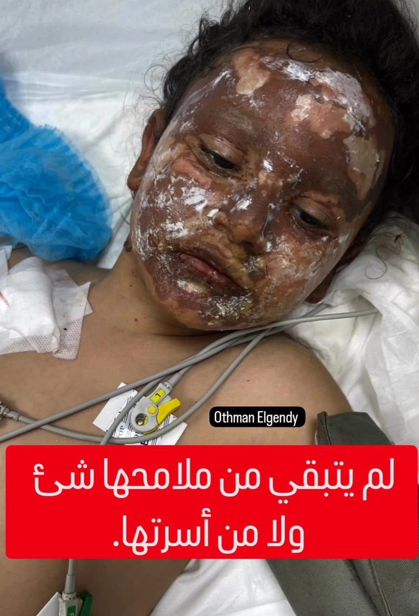 Astridueil's tweet photo. You did this @POTUS @RishiSunak @netanyahu @EmmanuelMacron @JustinTrudeau @GiorgiaMeloni @AlboMP @StateDeptSpox @vonderleyen @Bundeskanzler
#StopGazaGenocideNOW 
#WorldGlobalStrikeForGaza https://t.co/xs81uOkT2e