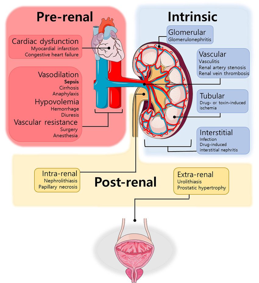PhKnowledge1's tweet photo. 📌 Main causes of Renal Failure https://t.co/7kT3IxD9Pe