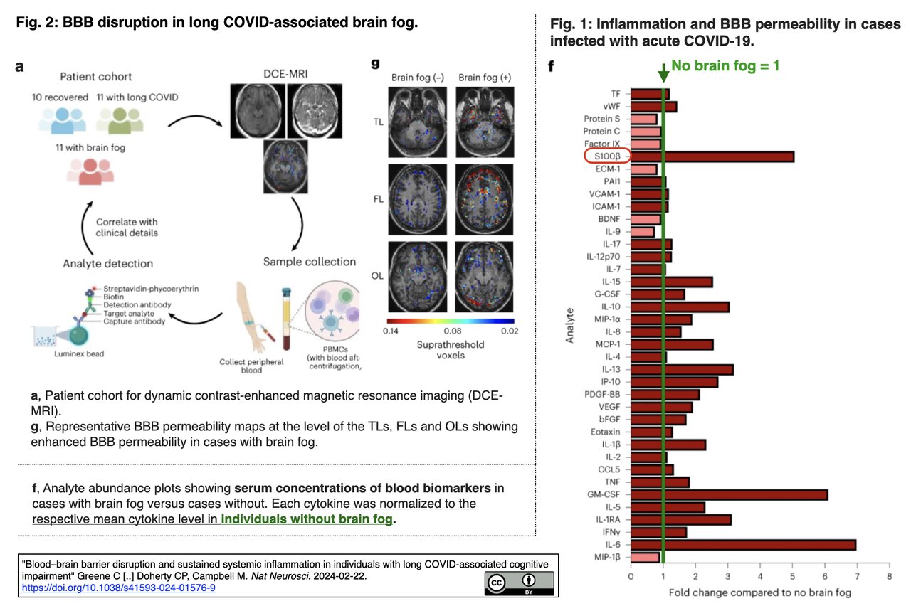 CRISP_SCIENCE on X: #ブレインフォグ (脳霧) に関連する血液脳関門の破綻と持続的な全身性炎症   Research Briefing Leaky blood–brain barrier in long -COVID-associated brain fog Nat Neurosci. 2024-02-22.   https