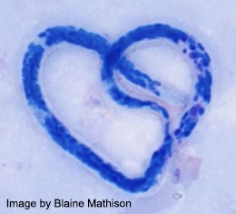 ParasiteGal's tweet photo. Don't forget that March and April are Filaria months! I will be posting a filarial case each week, courtesy of Idzi Potters and @ITMantwerp . Want to prepare? Check out  resources here: https://t.co/cagncX2HbO https://t.co/C8P4flqG3m