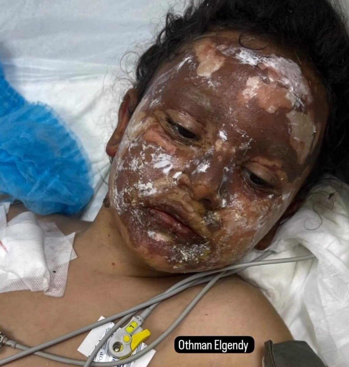 THEY BURNT HER ALIVE

THIS WAS WHAT AARON BUSHNELL’S MESSAGE WAS ABOUT