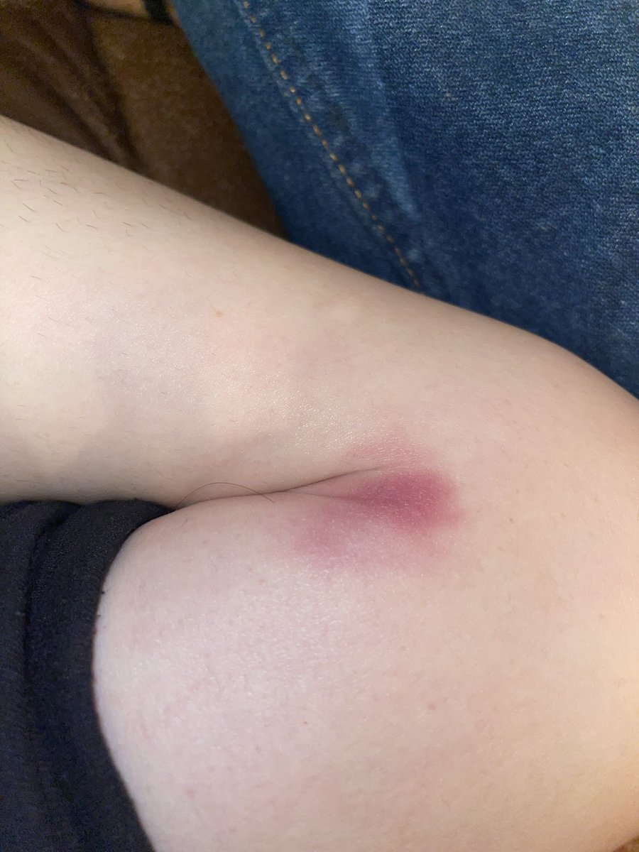 Morgan🏔 bruh moment tweet media