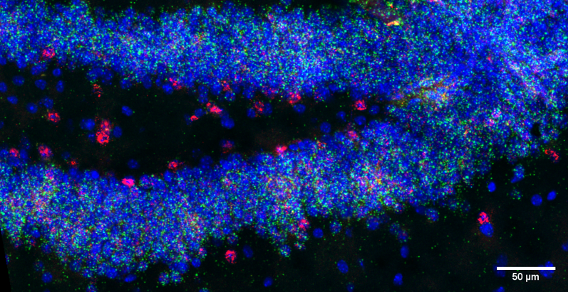 Centre for Genomic Regulation (CRG) (@crgenomica) on Twitter photo 📚 Learning and Memory Problems in Down syndrome Linked to Alterations in Genome's ‘Dark Matter’
Researchers at #CRG led by <a href="/maradierssen/">Mara Dierssen</a> and <a href="/CesarSierraN/">Cesar Sierra</a> as first author, reveal that the Snhg11 gene is critical for the function and formation of neurons in the hippocampus. 📚 Learning and Memory Problems in Down syndrome Linked to Alterations in Genome's ‘Dark Matter’
Researchers at #CRG led by <a href="/maradierssen/">Mara Dierssen</a> and <a href="/CesarSierraN/">Cesar Sierra</a> as first author, reveal that the Snhg11 gene is critical for the function and formation of neurons in the hippocampus.