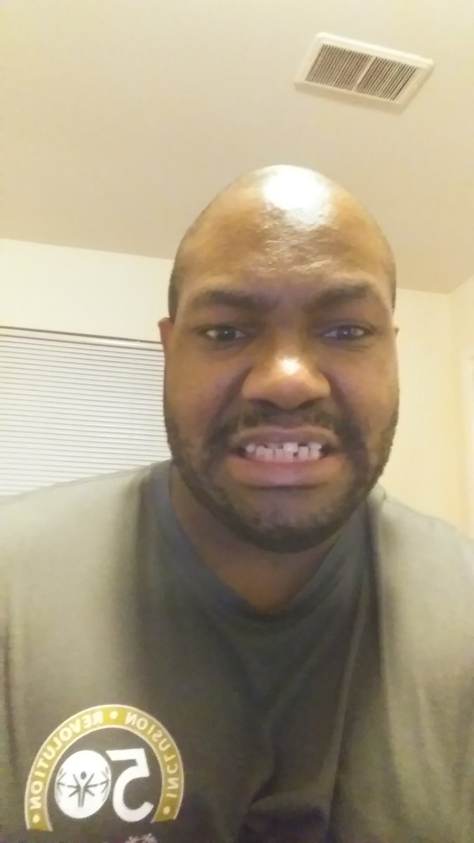 JackSmi75136167's tweet photo. I need help to raise money for my dental implants family and friends can y'all please help me out up with donation https://t.co/gzfHkQpqy9