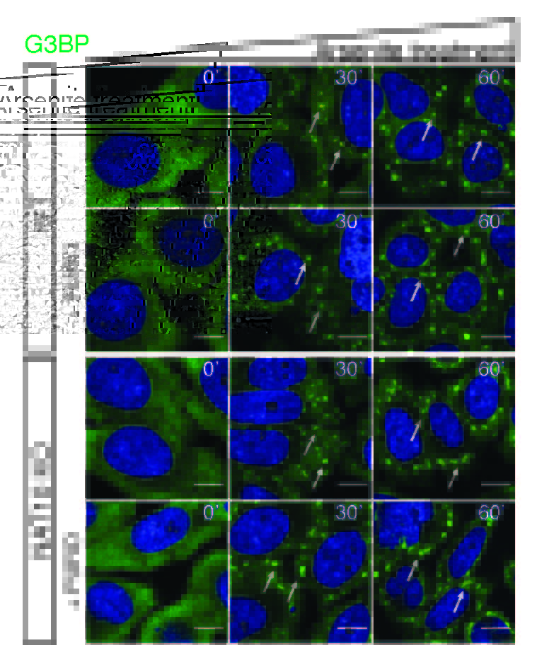 New discovery by @ulforom, @PavelKudrin et al. show how cells defend themselves during stressful situations where ac4C acts as a crucial defender, helping cells create protective storage units known as stress granules. tinyurl.com/36jeuu7b