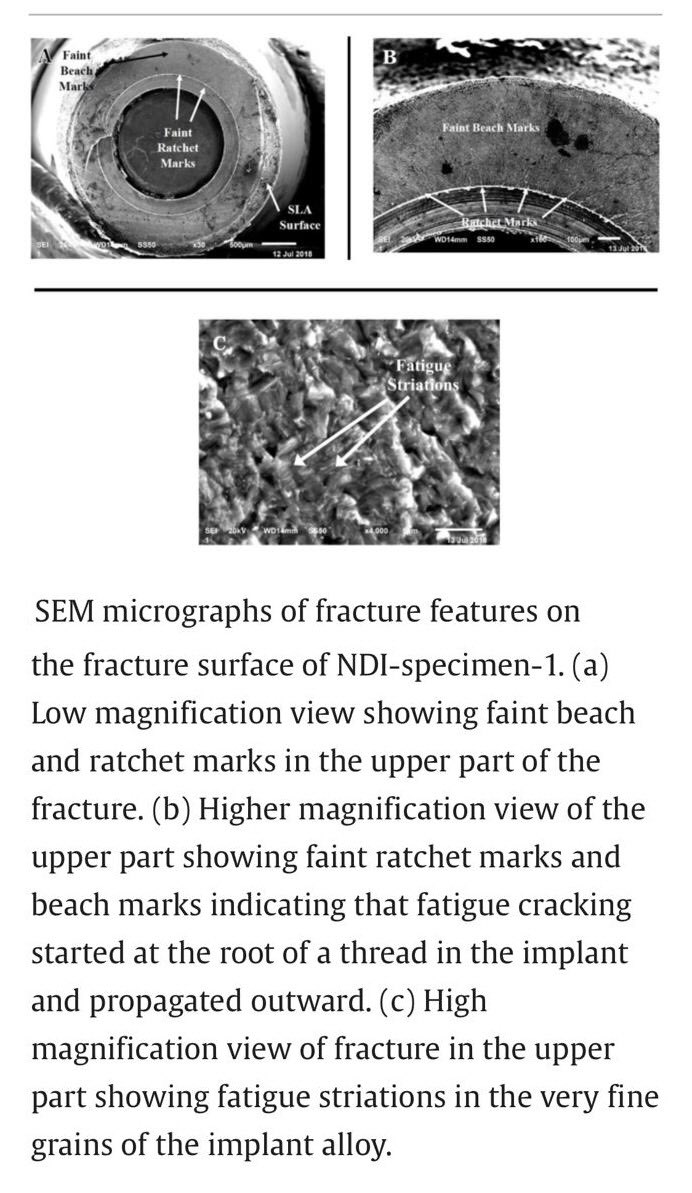 قد تكون هذه الدراسة نواة للباحثين لدراسة تفاعل الزرعات النحيلة للأحمال متعددة الاتجاهات خارج المحور وبعينات بحثية اكثر وبالتالي الوصول الى توجيهات و توصيات ذات اهمية عالية للأطباء -و إن لم تكن قطعية- بخصوص التصاميم الآمنه للتركيبات الثابتة عند استخدامها مع زرعات Roxolid النحيلة.