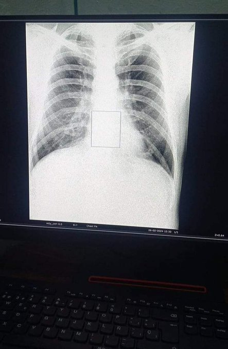 👩‍⚕️🧑‍⚕️ <a href="/YamileRamosCord/">Yamilé Ramos Cordero</a>: ¨Un nuevo equipo de radiografía digital quedó instalado en el municipio #Guane de #PinardelRío, que asegura una mayor calidad y precisión en el diagnóstico.¨
#CubaPorLaSalud