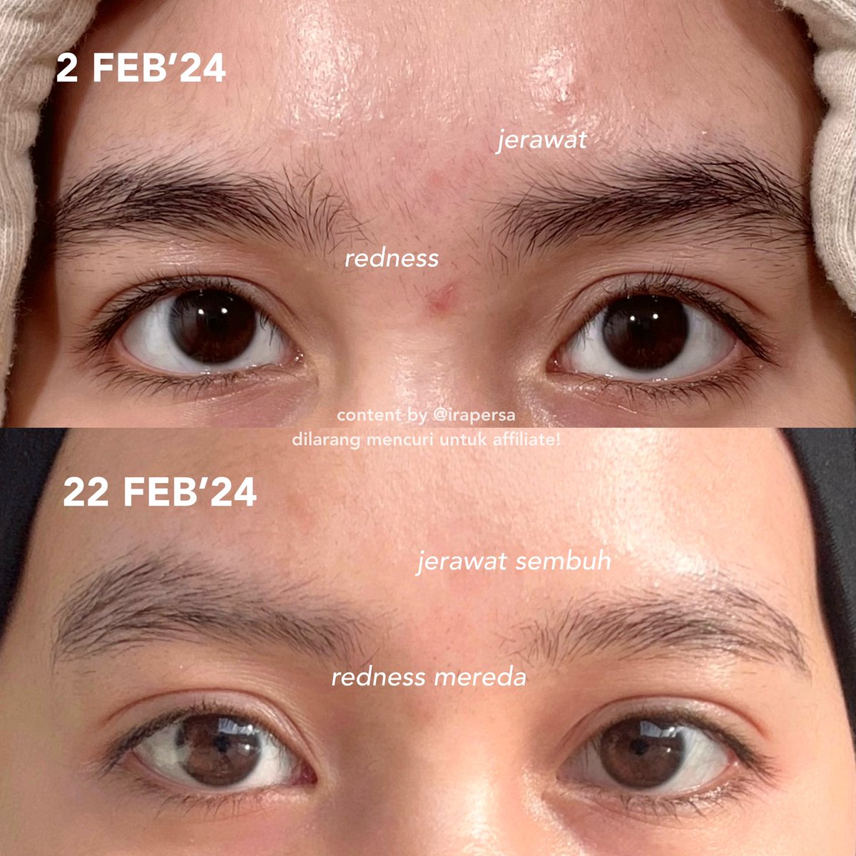 irapersa's tweet photo. one of favorite combo this february!<3

bulan ini tuh kulit aku lagi rewel banget, sampe muncul jerawat mendem &amp; redness di beberapa spot.

tapi sekarang udah mendingan, senengnya. https://t.co/wH1odPqxqo