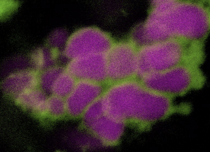 TakinoueLab's tweet image. We have uploaded a new article &quot;DNA-origami-armored DNA condensates&quot; on ChemRxiv: go.shr.lc/3IcN7OP  with
@Yusuke_Sato_510
#DNADroplet #DNAOrigami #ArtificialCell #LLPS