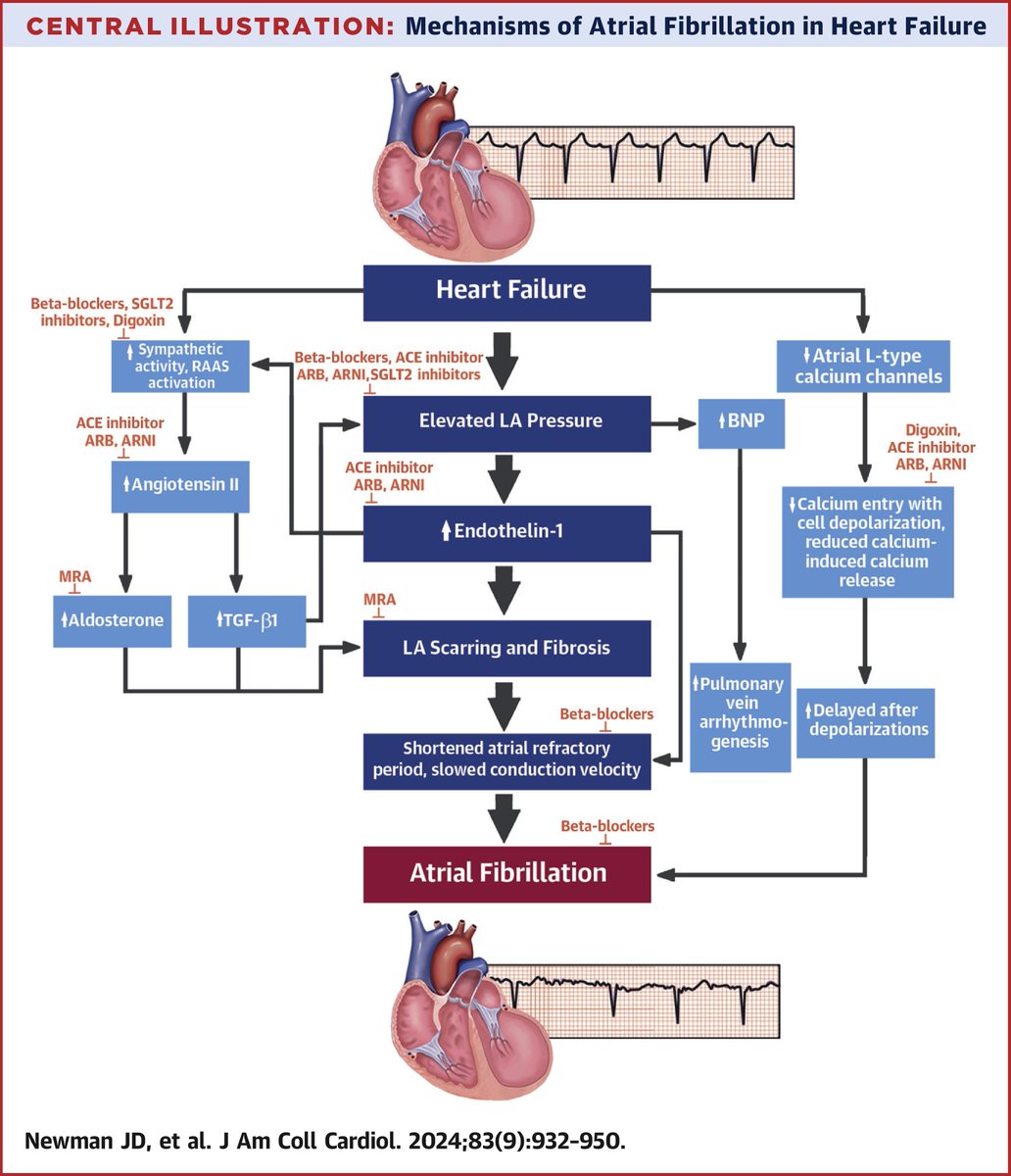 Atrial fibrillation & #heartfailure commonly occur together, & the combination is assoc. w/ a worse prognosis than either condition alone. This #JACC state-of-the-art review explores the impact of #GDMT on #AFib & the impact of AF on the efficacy of GDMT bit.ly/3UVvPgx