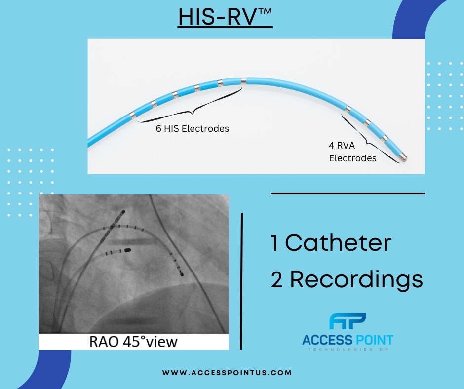 EPMap_iT's tweet image. Saving time has NEVER been more important! We provide a line of HIS-RV™ catheters that allow you to place 1 catheter and record from 2 sites:
With a proximal Hexapole for the HIS and a distal Quad for the RVA, Achieve simplified more cost-effective procedures.

#HISRV #MapiT #EP