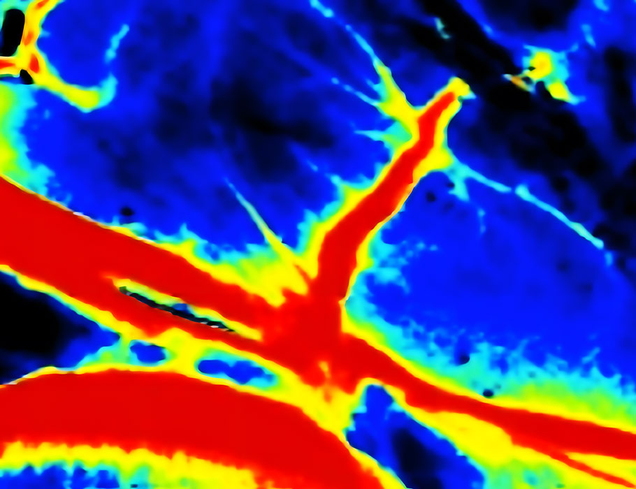 SciRobotics's tweet image. A non-invasive, real-time framework laser speckle contrast imaging involves no radiation. 

During tests, it successfully tracked the movements of a swarm of #nanorobots in blood vessels ex vivo and in vivo. Learn more in Science #Robotics: scim.ag/60W @CUHKofficial