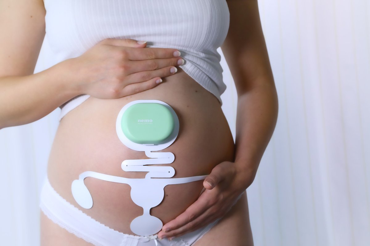 In childbirth, monitoring of contractions is key to ensure safety for the mother and child. Kirsten Thijssen looked at ways to improve a non-invasive way of monitoring contractions based on measuring electrical activity from the uterus. Read more 👇 tue.nl/en/news-and-ev…
