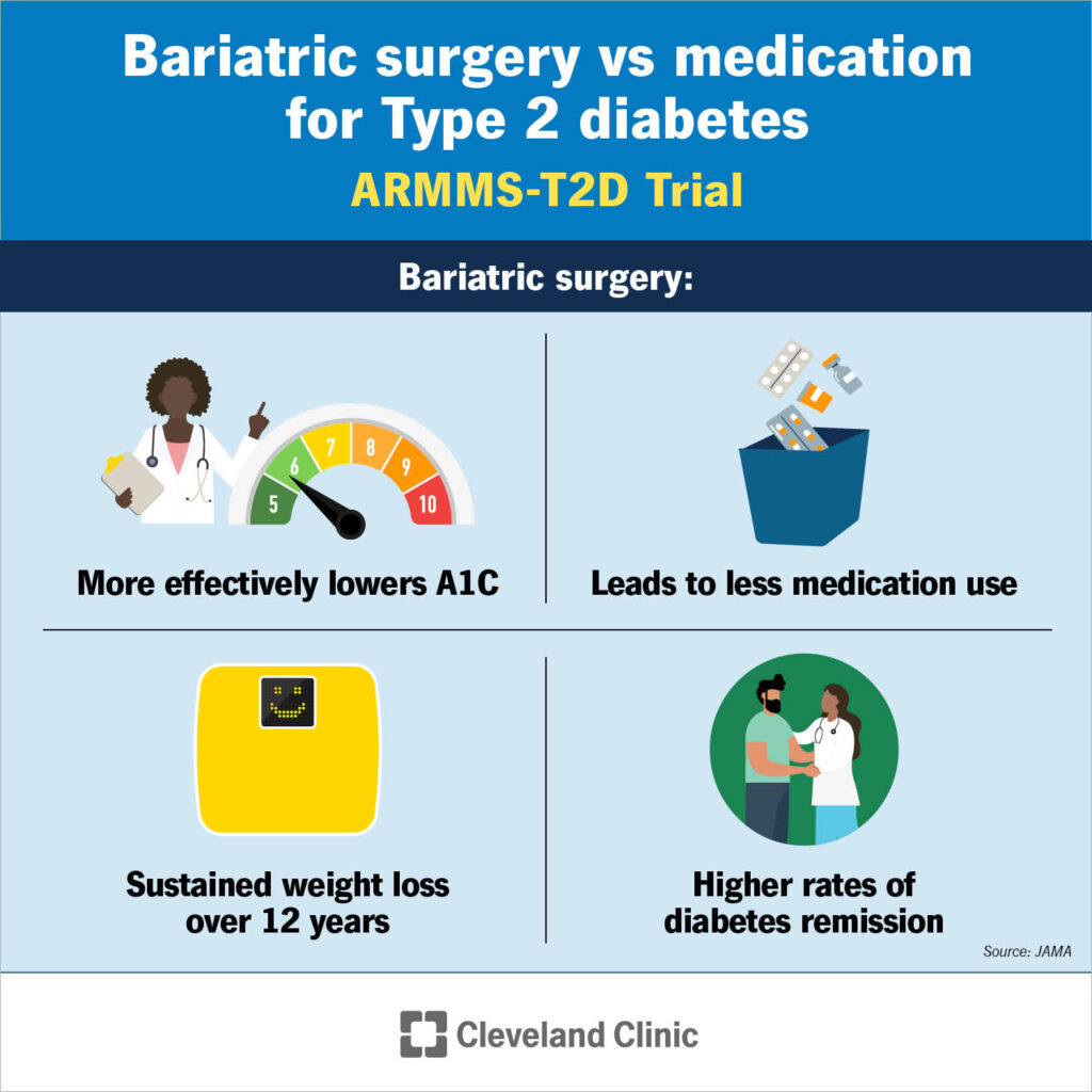 Bariatric Surgery Provides Superior Long-Term Treatment for Type 2 Diabetes in Patients with Obesity. Twelve-year data indicate greater weight loss and fewer diabetes medications after bariatric surgery compared to usual care. newsroom.clevelandclinic.org/2024/02/27/stu…