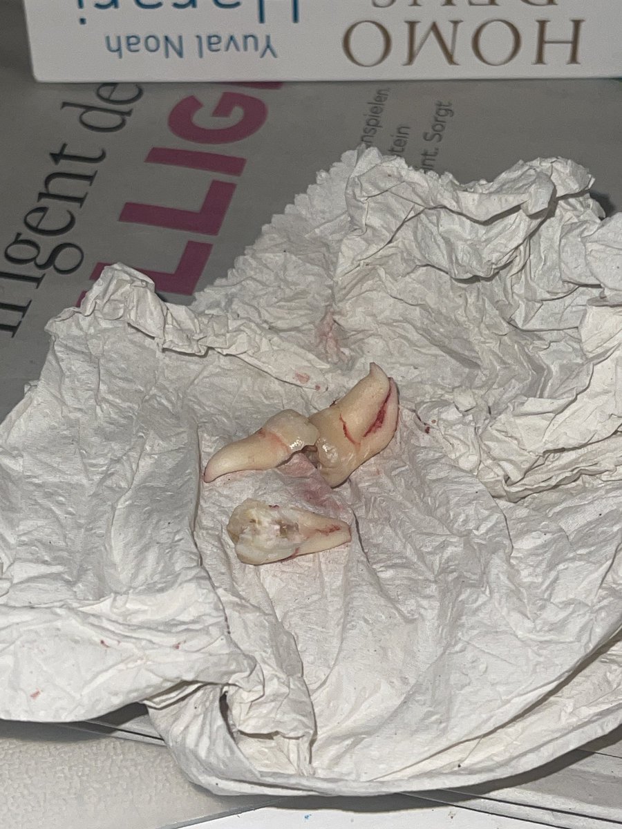 larswith27a's tweet photo. They ripped out my wisdom teeth today😭 But Im fine, painting again ✌🏼 gn https://t.co/GmxnvqRen5