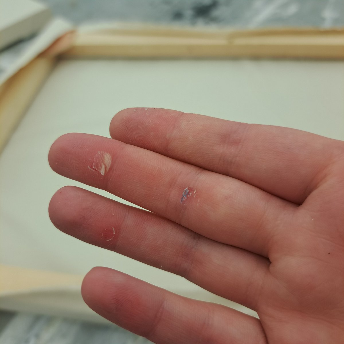 yeeeeeeeowch!
