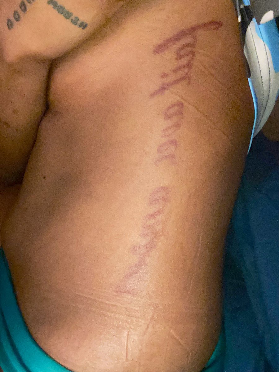 ChairreH's tweet photo. @niccoyat I’ve had this tattoo for 3 months. I Just took this pic (ignore the sleep lines💀) but the ending part healed kinda faded bc I believe he couldn’t tell the red ink from blood and was doing it too hard and it’s on my side so my curves made it difficult to do. Pain scale: 100/10 https://t.co/FvhFct81cy
