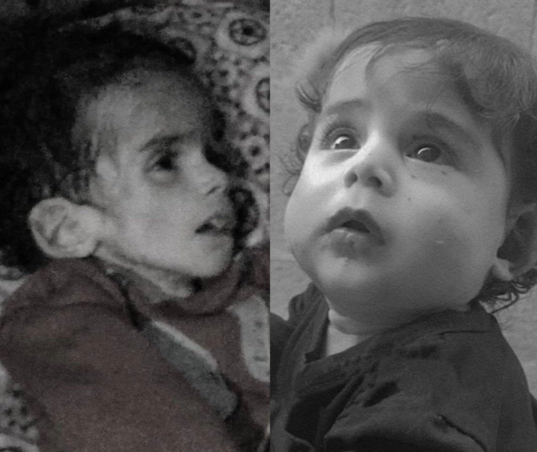 يا اللّه ، صورة صادمة ..

الطفلة أنهار استشهدت بسبب الجوع والجفاف.

نحن نتحدث عن كارثة بشرية ليس لها مثيل.