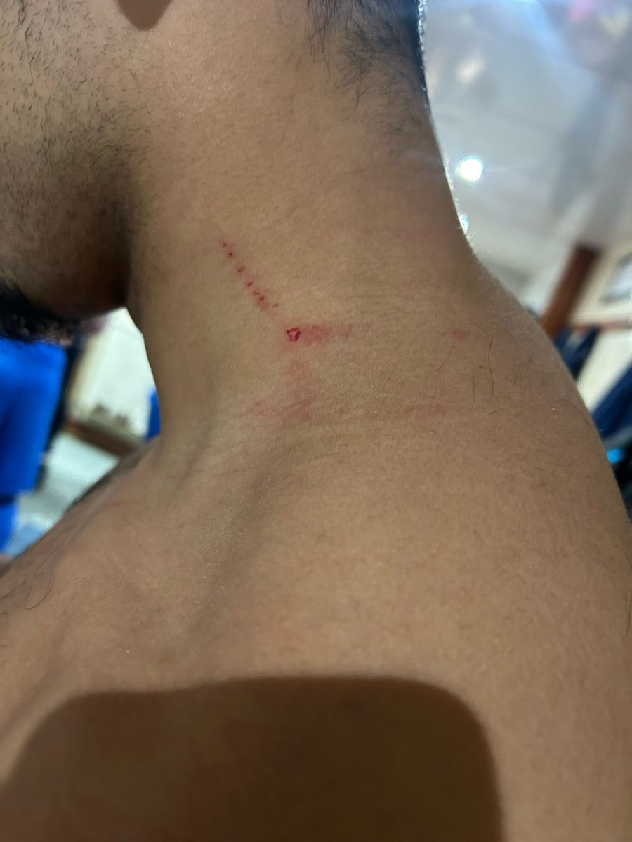 Qasim Khan (@qasimk_9) on Twitter photo Always nice to beat your old team, especially when they got dog shit defenders bitting you on the shoulder 😭🍽️ #tasteslike3points <a href="/WembleyFC/">Wembley FC</a> Always nice to beat your old team, especially when they got dog shit defenders bitting you on the shoulder 😭🍽️ #tasteslike3points <a href="/WembleyFC/">Wembley FC</a>