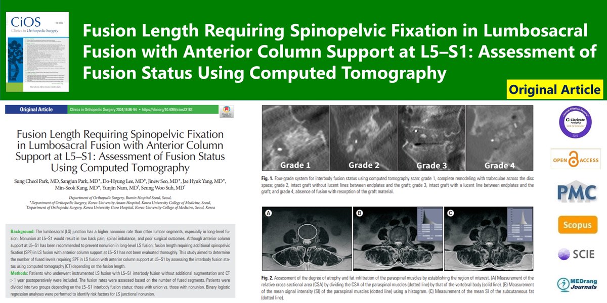 CiOSjournal's tweet image. Fusion Length Requiring Spinopelvic Fixation in Lumbosacral Fusion with Anterior Column Support at L5–S1: Assessment of Fusion Status Using Computed Tomography
🌷doi.org/10.4055/cios23…
16(1) Sung Cheol Park
#Lumbosacral_region #Pseudarthrosis #Spinal_fusion #Spinopelvic_fixation