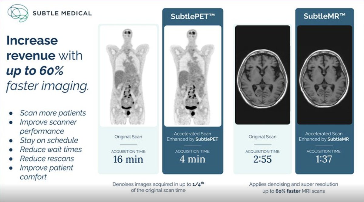 SubtleMedical's tweet photo. At #ECR2024, we're excited to announce the updated #SubtlePET and #SubtleMR products are now #CE-marked under the new EU #MDR. The Subtle team will present our latest research highlights, featuring our most recent innovations in enhancing AI-powered breast MR with better lesion visualization.
The #ECR presentation “Looking beyond standard dosage in dynamic contrast-enhanced breast MRI using a pre-trained deep learning model” will be given at the session “Advances in Breast MRI Techniques”. These advancements underscore our commitment to accelerating and enhancing AI-powered imaging #SubtleAI for better patient care worldwide. #SubtleBOOST #SubtleMR #ECR2024