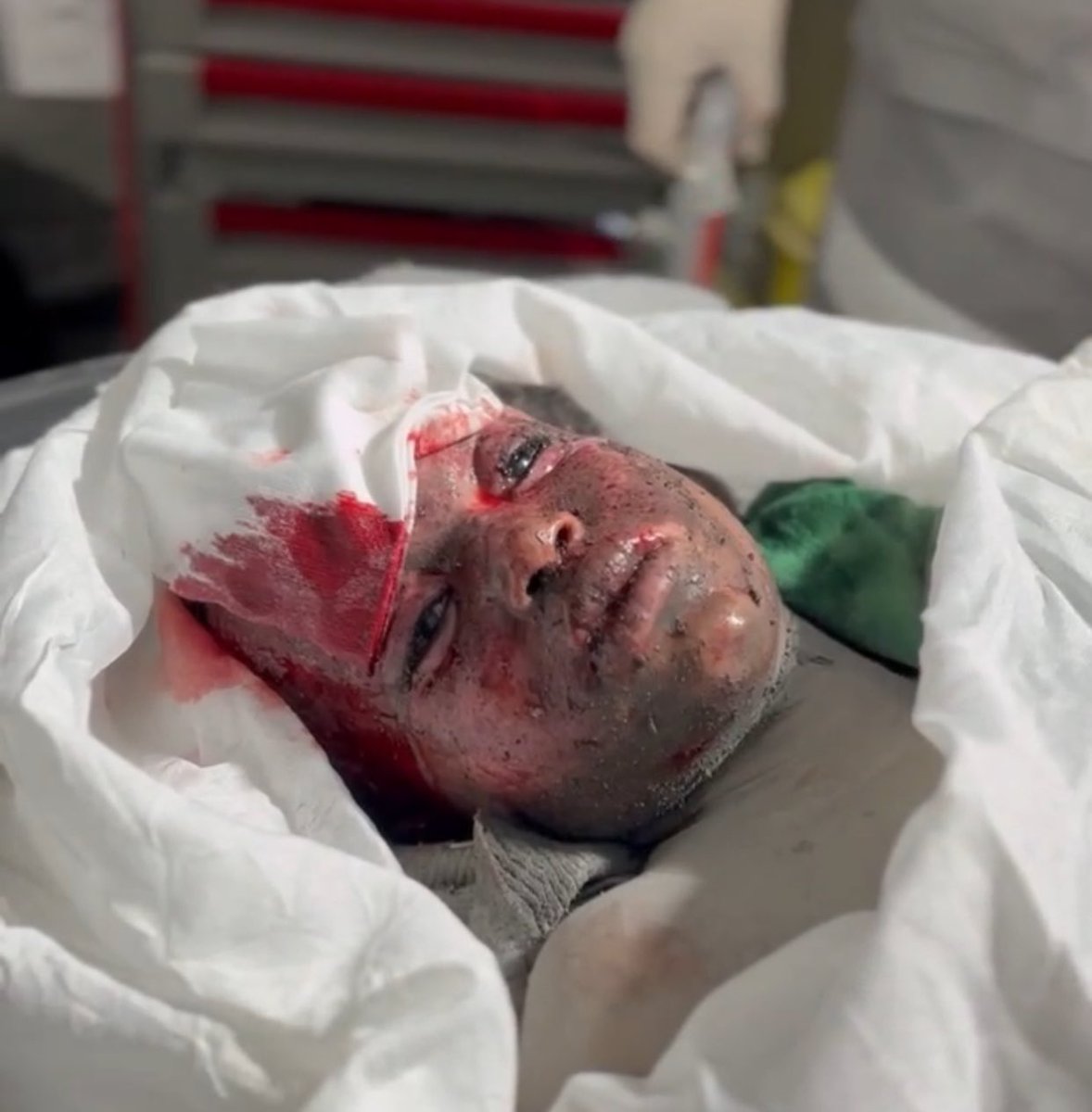 HUMANITY IN THE ABYSS
The last breath of a child after his house was bombed today in Rafah town.#StopGazaGenocideNOW