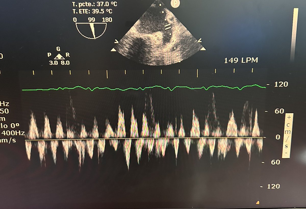 Today in our Echolab 👀🖥️ La orejuela diciendo el ritmo 🎶 <a href="/ecolabincich/">INC Echo Lab</a>