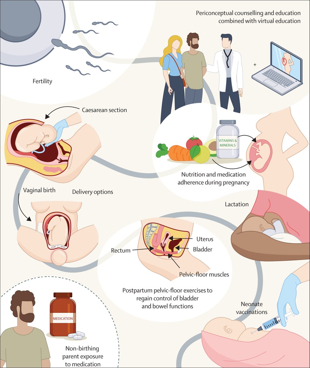 TheLancet's tweet image. Fertility, pregnancy, and childbirth are pivotal life events that are affected by inflammatory bowel disease.

In a new Seminar, authors provide the latest evidence regarding issues to be considered for optimal pregnancy outcomes in people with IBD: hubs.li/Q02nkRsj0