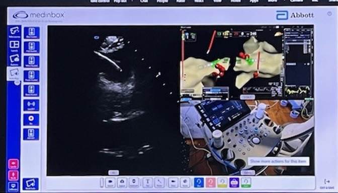 Jacqueline Held (@jacqueheld_ep) on Twitter photo At <a href="/AbbottCardio/">Abbott Cardiovascular</a>, we can provide Connected Care through Medinbox. Specialists can stream in and provide insight and feedback real time during our cases. This tool is incredibly valuable to the success in our EP growth! #EnsiteX #ConnectedCare #Medinbox #AbbottProud <a href="/ThomasHGuest/">Thomas Guest</a> At <a href="/AbbottCardio/">Abbott Cardiovascular</a>, we can provide Connected Care through Medinbox. Specialists can stream in and provide insight and feedback real time during our cases. This tool is incredibly valuable to the success in our EP growth! #EnsiteX #ConnectedCare #Medinbox #AbbottProud <a href="/ThomasHGuest/">Thomas Guest</a>