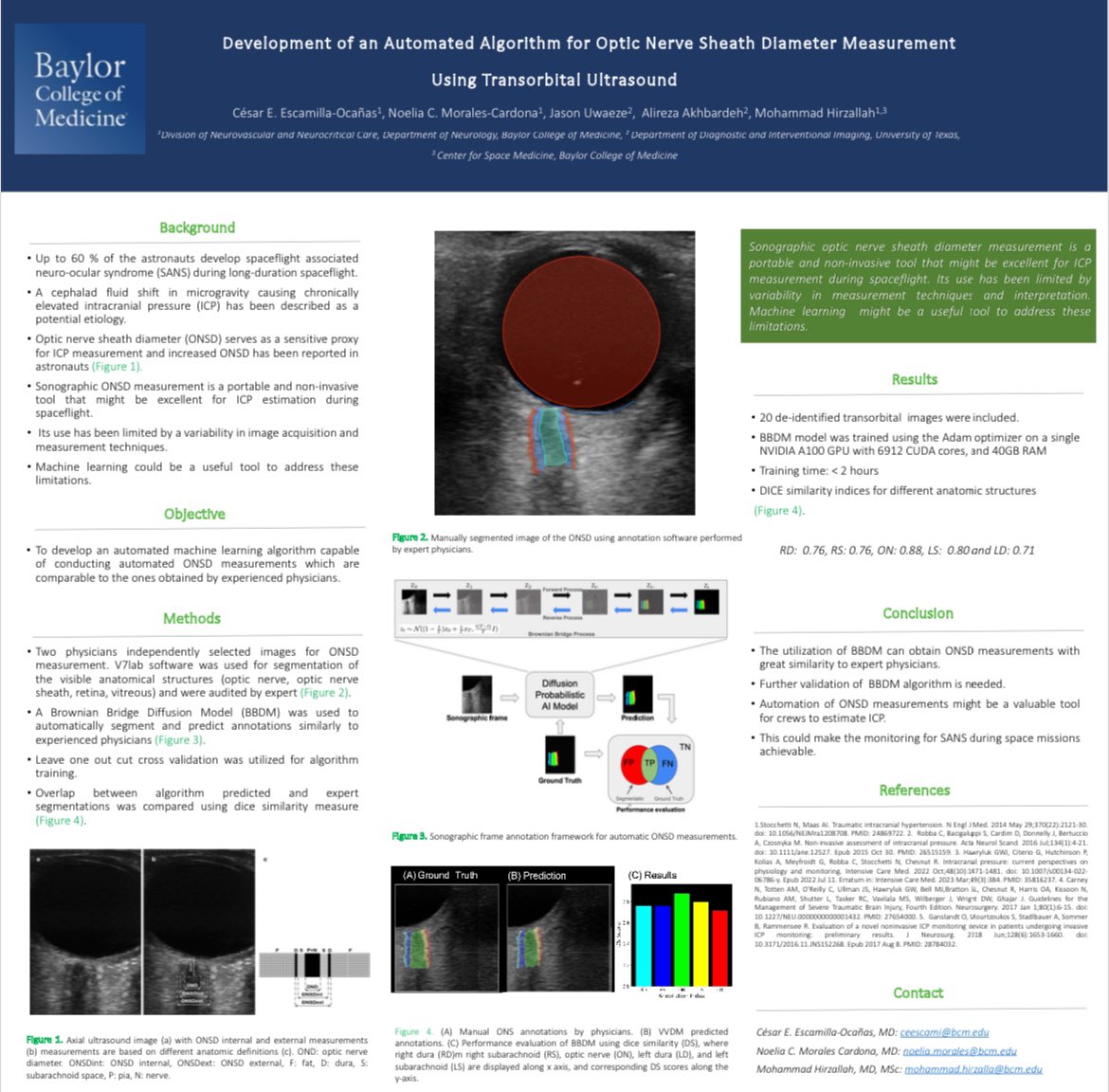 César Escamilla (@cescamillamd) on Twitter photo Excited to share our team was awarded 2nd place at <a href="/NASA/">NASA</a> HRP IWS 2024 poster competition! 🚀 Big thanks to all involved and specially our mentor <a href="/7irz/">Mohammad Hirzallah</a>!
<a href="/NoeliaCristina_/">Noelia Morales</a> <a href="/bcmneurology/">BCM Neurology</a> <a href="/bcmhouston/">BCMHouston</a> <a href="/BCMSpaceHealth/">Translational Research Institute for Space Health</a> Excited to share our team was awarded 2nd place at <a href="/NASA/">NASA</a> HRP IWS 2024 poster competition! 🚀 Big thanks to all involved and specially our mentor <a href="/7irz/">Mohammad Hirzallah</a>!
<a href="/NoeliaCristina_/">Noelia Morales</a> <a href="/bcmneurology/">BCM Neurology</a> <a href="/bcmhouston/">BCMHouston</a> <a href="/BCMSpaceHealth/">Translational Research Institute for Space Health</a>