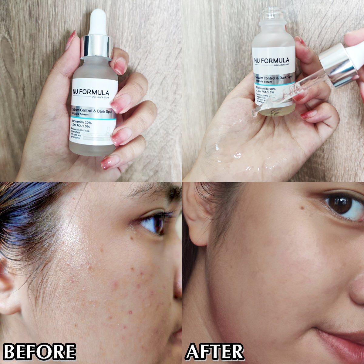 ลองใช้แล้วบอกเลยว่าดี ดูรูปได้คือช่วงที่ฝุ่นเยอะ เราแพ้แล้วทั้งสิว ทั้งผื่นขึ้นมาเยอะมากๆ แล้วพอใช้ NU FORMULA ขวดนี้ ช่วยให้ผิวหน้ามันดีขึ้นเลย เป็นแอมพลูเซรั่มลดผิวมัน ลบรอยสิว จากที่มีริ้วรอยในก่อนหน้านั้น ตอนนี้กลับมาใสแล้วแถมความันลดลงด้วย✨

พิกัด;bit.ly/3SD3n0i