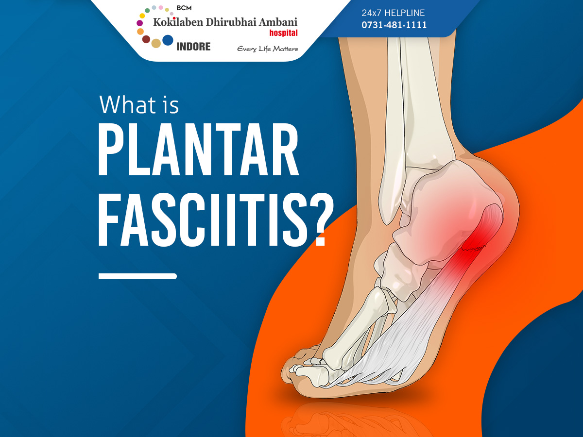 #Plantarfasciitis results from overuse or strain on the plantar fascia, leading to #heelpain, swelling, and stiffness. Home remedies like ice, rest, supportive braces, and over-the-counter pain relief can help alleviate symptoms. If pain persists, seek medical attention.