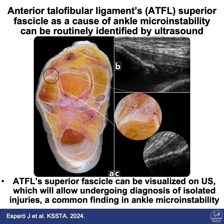 Knee Surgery, Sports Traumatology, Arthroscopy tweet media