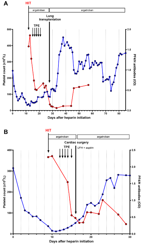 GendronNico's tweet photo. 🎉I am thrilled to share our experience with therapeutic plasma exchange during acute heparin-induced thrombocytopenia 💥in patients on #ECMO before surgery #HIT #TPE
@DorotheeFaille @romsonnevil @VGkalea @hopitalbichat 
@HopitalPompidou @TH_Journal 
https://t.co/I6KzQMcYzc https://t.co/fkLWeSukd0