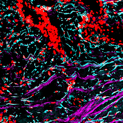 D-BIOL @ ETH Zurich (@eth_dbiol) on Twitter photo New study by <a href="/WernerLabETH/">Werner Lab ETH</a> & Wennemers Group in Matrix Biology unveils a chemical probe to track #collagen changes during #woundhealing.
More: biol.ethz.ch/en/news-and-ev… New study by <a href="/WernerLabETH/">Werner Lab ETH</a> & Wennemers Group in Matrix Biology unveils a chemical probe to track #collagen changes during #woundhealing.
More: biol.ethz.ch/en/news-and-ev…
