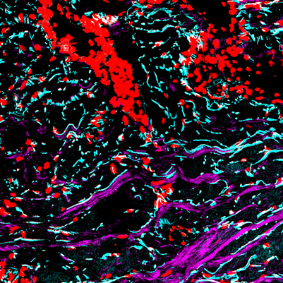 New study by @WernerLabETH & Wennemers Group in Matrix Biology unveils a chemical probe to track #collagen changes during #woundhealing. More: biol.ethz.ch/en/news-and-ev…