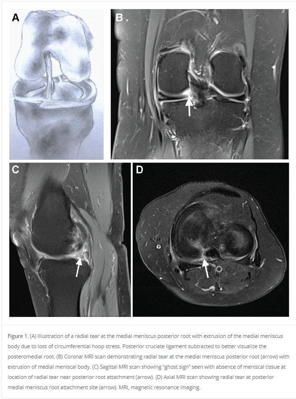 OJSM_SportsMed tweet media