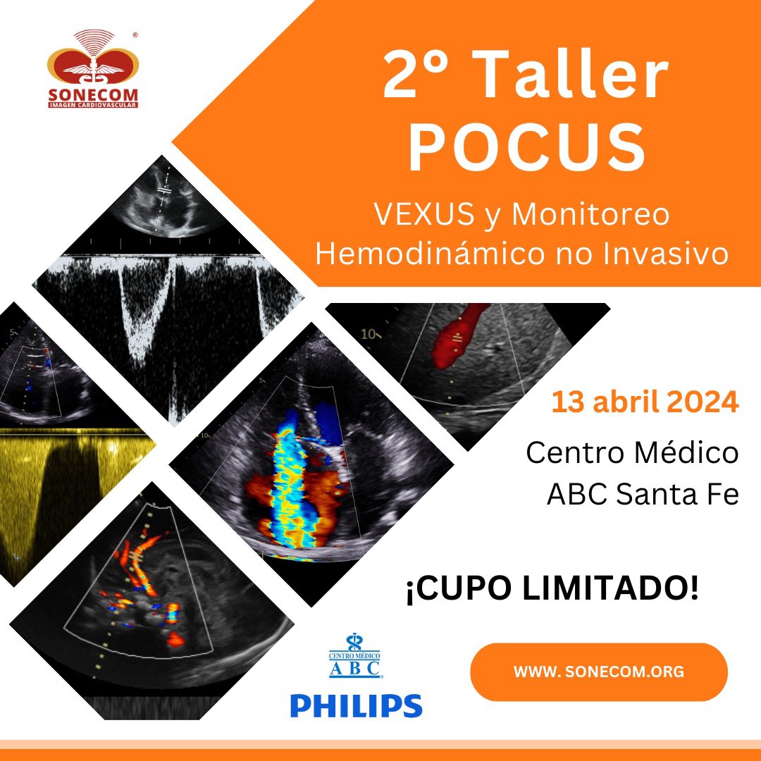 🎉Porque tú lo pediste... 2° taller de POCUS y Monitoreo Hemodinámico en el paciente en estado crítico🫀

🗓️Sábado 13 de abril
📍Centro Médico ABC Santa Fe
Costo: $2,500.00 MXN

Regístrate 👉 bit.ly/3uG7jWd
Conoce el Programa Académico 👉 bit.ly/3wAnXqL